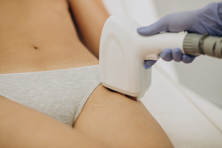 Epilare definitivă inghinală: de câte ședințe ai nevoie și cum te pregătești pentru tratament